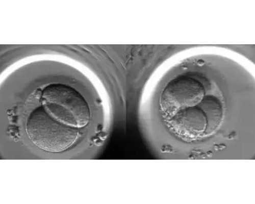 古董古玩交易中心微信号_如何运动瘦小腿