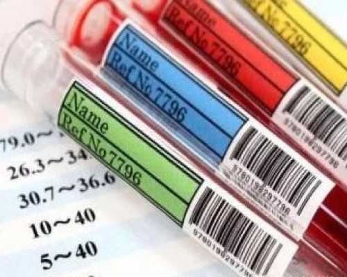 香港验血5周和六周验血方式一样吗,《我的姐姐是美女》的主要内容介绍