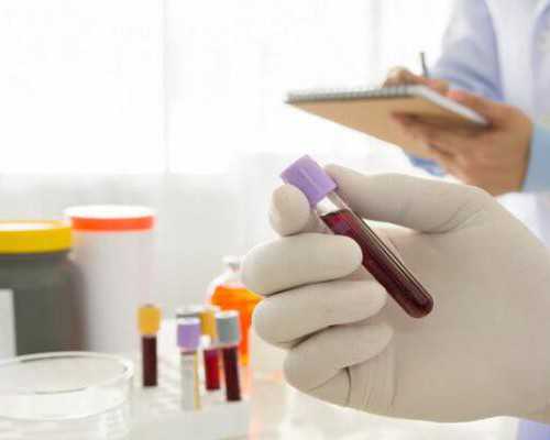 香港验血dna测性别准确吗_香港dna测性别准确吗？一般怎么收费的？