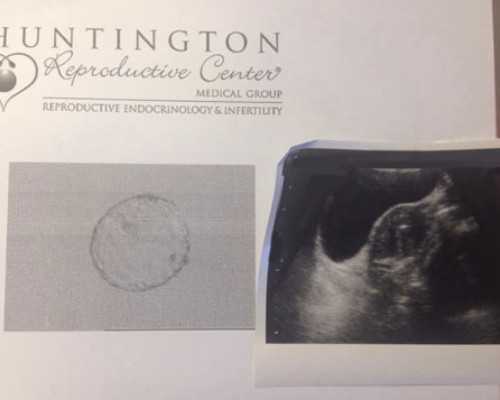 有人去香港验血查男女_香港验血查孕准确吗_6周验血男女准不准总共多少钱