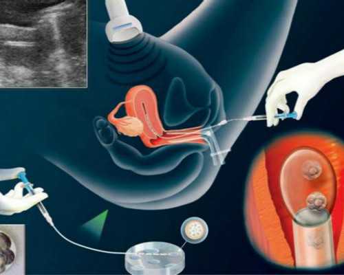 孕期香港验血需要复查_香港刘仲庭验血准吗_验血结果还有可能翻盘吗!