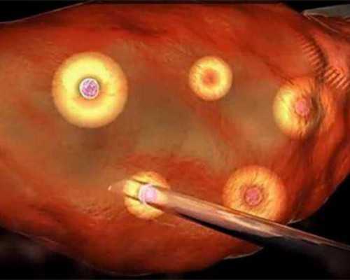 流产5个月怀孕香港验血_双胞胎香港验血_dna胎儿性别邮寄准不准