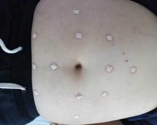 香港验血男女结果图_香港仁建医院验血_查男女哪个化验所最准确!