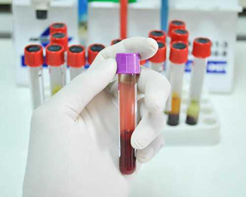 15周香港验血准吗_香港四大验血机构_最全攻略全在这!