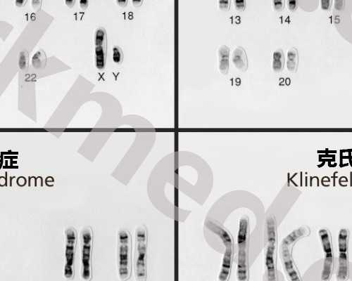 香港化验血周末休息吗_去香港查孩子男女准吗,给大家的建议