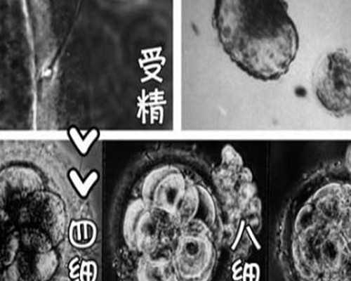 香港验血13个d是男孩吗_香港验血代理商_香港验血的费用是多少!