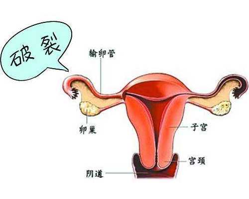 香港验血当天可以出结果吗,试管婴儿微刺激方案移植