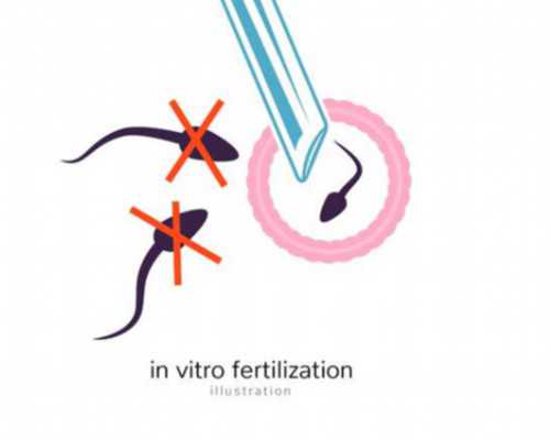 香港验血孕囊要5还是10_香港验血检测男女吗_香港验血报告怎么看!