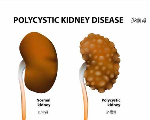 香港dna验血胎儿性别哪家准_香港验血查性别深圳机构_验血查男女几周是最准呢