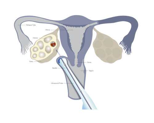 广州代检香港八周验血_去香港验血查胎儿性别有翻盘的吗?，怀孕几周查？