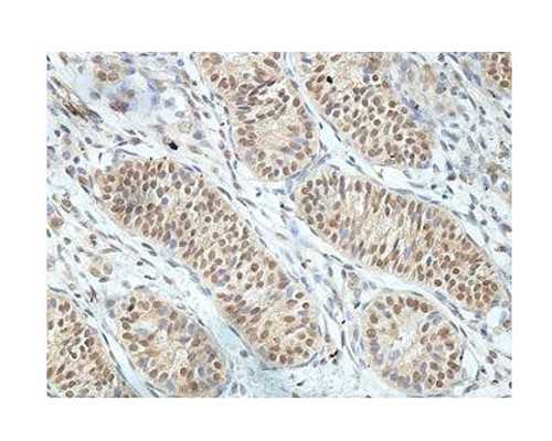 去香港如何验血测性别_怀孕多久可以验血测男女,测男女结果会翻盘吗？