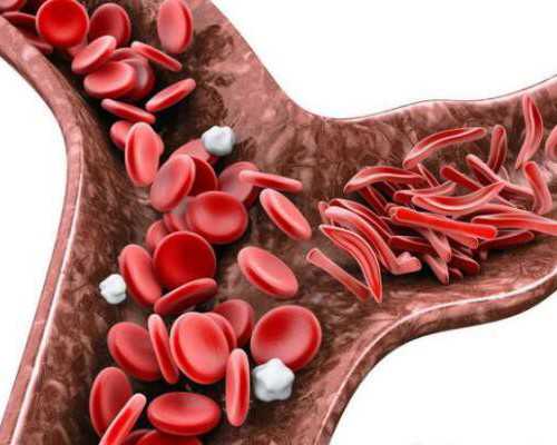 香港验血邮寄化验所_林志玲女神结婚啦！爆想生双胞胎！