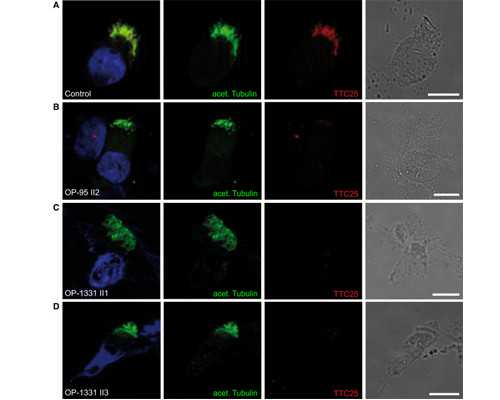 去香港验血多少天知道结果_香港血液性别鉴定单,亲身经历详细攻略