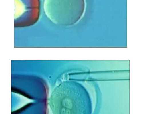 香港验血医院的app,孕妇可以吃柿子吗？女性经期吃柿子会导致痛经？