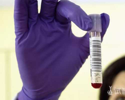 怀孕两月香港验血_6周香港验血查男女准吗_都有哪些需要注意的