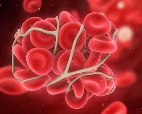 香港孕妇验血原理_关于下雪了的作文描写冬天下雪的作文