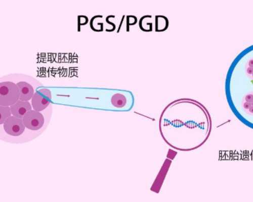 香港PG化验所验血女孩_香港验血不准的原因_验血攻略及流程说明!
