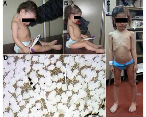 怀孕去香港验血测男女,排卵障碍能做试管婴儿吗