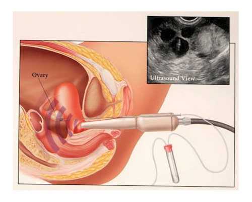 刘金山玩古玩电视剧_白米饭吃多了不仅会胖还会患癌