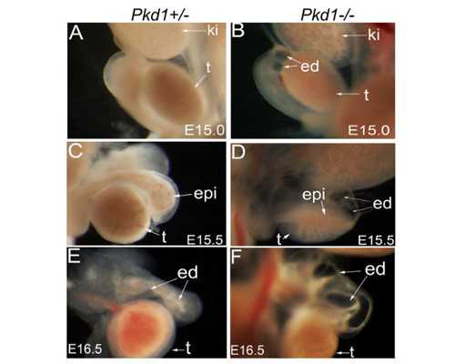 香港验血不准的个案_香港验血鉴定男女怎么看报告单_验血查性别准不准!
