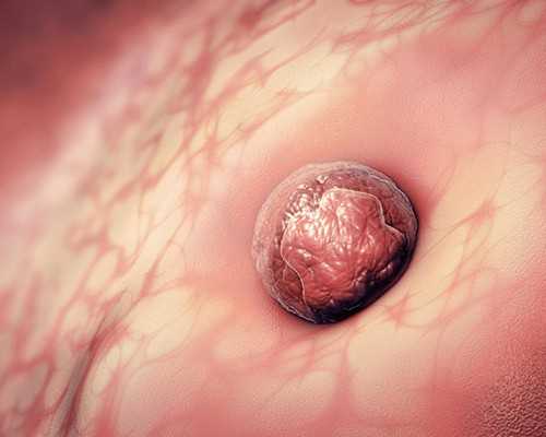 香港验血几周不需要半年内流产,旦旦医学｜试管婴儿一次生双胎可靠吗？专家