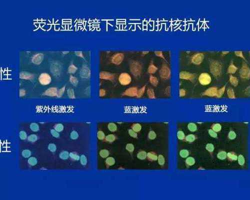 古玩虫电视剧5集完整版免费观看_猪血酸菜汤，小吃店必点