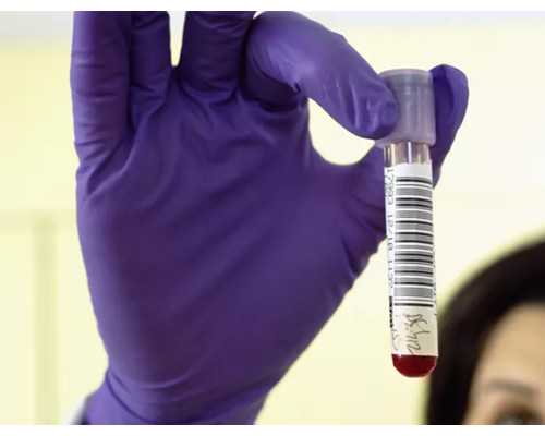 怀孕香港验血几周_香港孕妈妈验血费用多少钱啊?想知道，有必要学会这几招