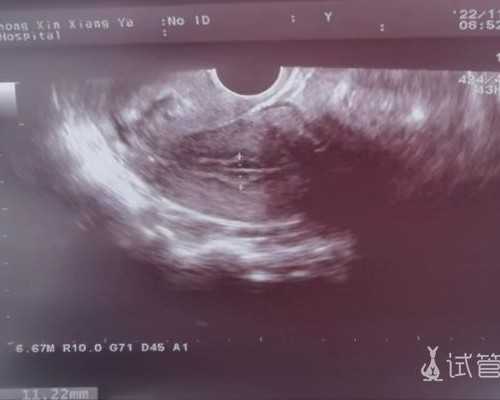 银川寄往香港验血中介_刚怀孕去香港能验男女_查男女几天出可以出结果!