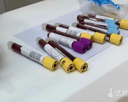 香港验血正現医院有哪些_邮寄香港验血查性别准不准_需要预约吗具备什么条件