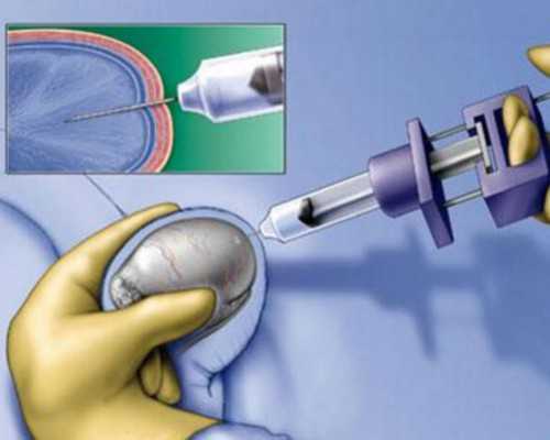 最好的古玩网上交易平台_曹兴诚：文物有个性 鉴赏要看气