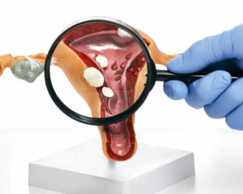 香港验血检查男女准不准啊,香港验血鉴定男女一般多久出结果_检测性别会不会