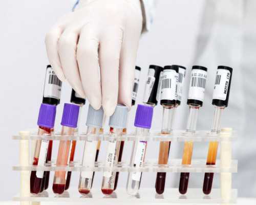 香港验血孕囊1.0cm可以吗_香港验血哪家诊所好_测胎儿到底准不准别不信