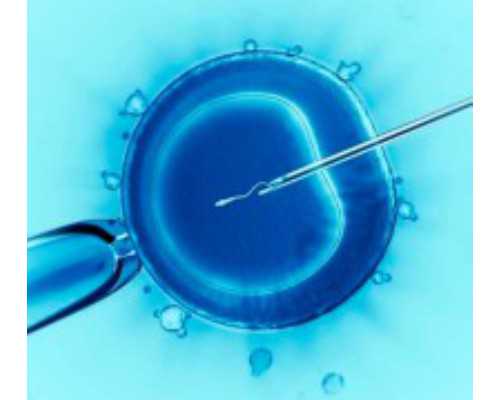 二胎验血香港攻略_香港测男女机构_检测到有Y染色体却生的女孩