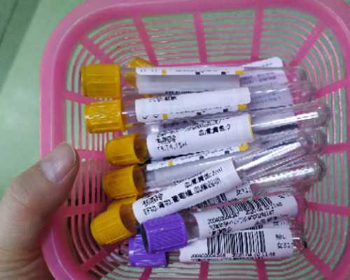 香港验血男女 什么情况下会验不出来,试管前的精液检查有什么需要注意的？染