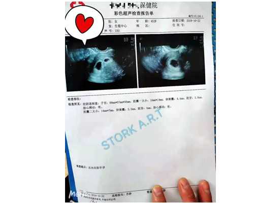 去香港验血看性别是可以寄的吗_香港验血测胎儿性别准吗,分享一下本人亲身经