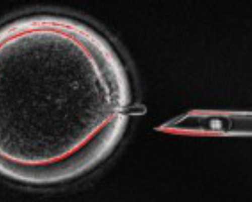 香港验血寄血不会坏吗_香港PG验血地址是什么_dna胎儿性别是骗人的吗!