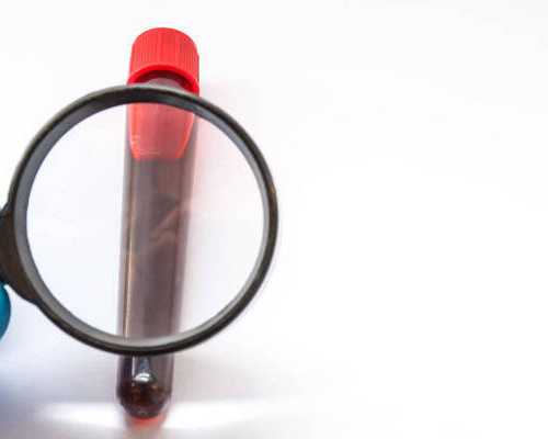 香港验血一般多久出结果_香港b超查性别_查性别详细流程是什么!