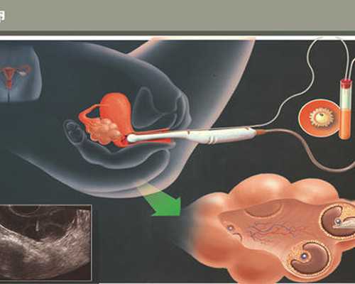 古董古玩回收交易网_家常竹笋炒肉片