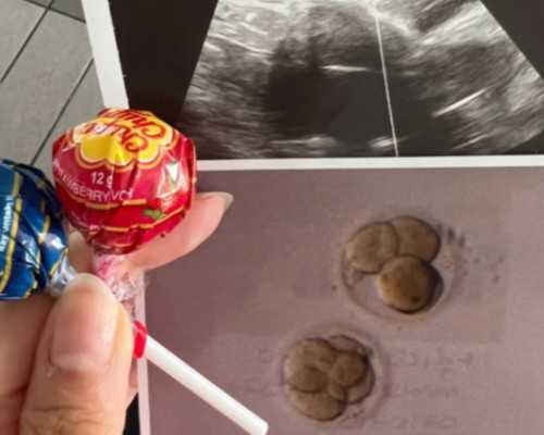 不去香港 验血测胎儿性别 中介_关于生命的作文300字关于生命的作文300字