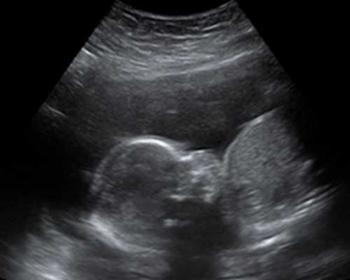 双胎减产后去香港验血男女_香港哪里可以查男女性别_验血哪个机构最权威