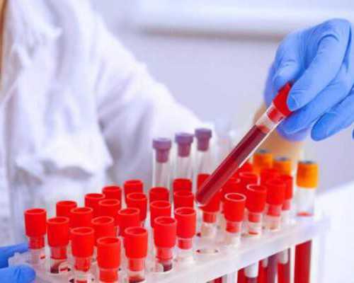 香港dna验血准确率_中考满分作文 雨露关于雨露的作文(600字),急需!!!