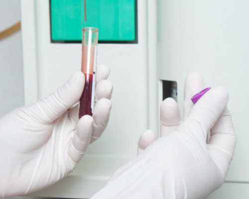 香港验血验11个y准吗_香港验血测胎儿几周_验血查性别哪家最准!