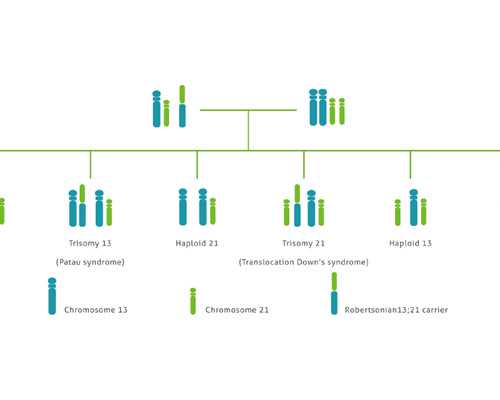 香港验血辨男女当天能出结果吗,美国第二代试管婴儿：单精子注射会导致染色