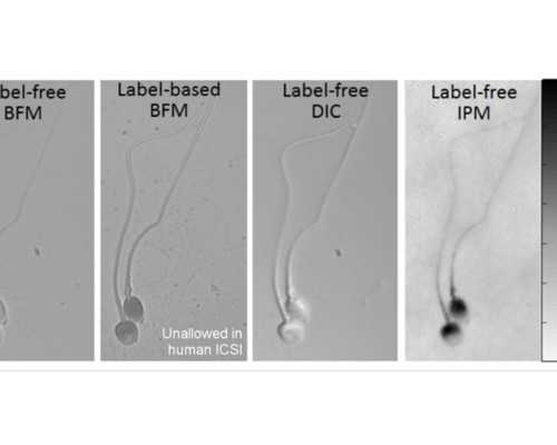 怀孕后香港几周可以验血_香港验血查胎儿男女的流程费用_预约鉴定性别哪家最