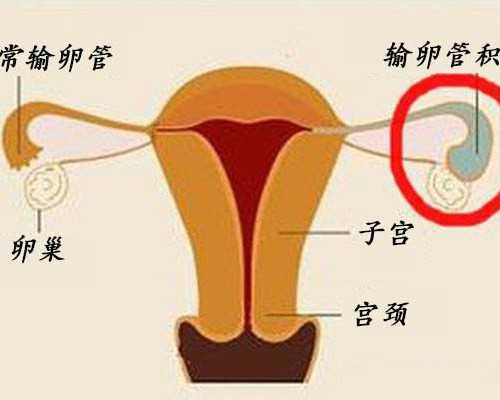 香港验血男女不准,试管婴儿好还是自然怀孕好