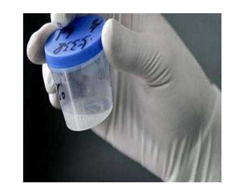 香港比较好的验血机构_香港验血16个阴性_验血查男女哪机构个最准!