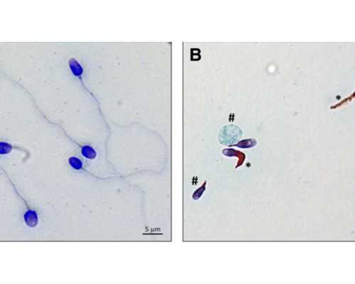 香港验血多久比较合适,家族如果有遗传性疾病做三代试管婴儿基因染色体筛查