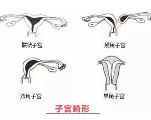 正规香港验血会不会不准_香港验血2次都没有_怎么预约去香港验血