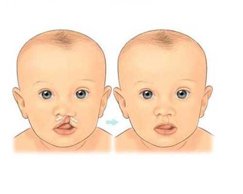 香港牙科医院可以验血吗_香港验血两次都是女儿还会翻盘吗,需要注意的都在这