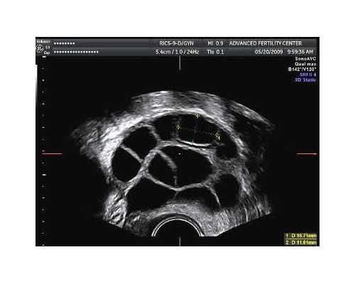 阜新有鉴定古玩的地方吗?,城府最深的月亮星座
